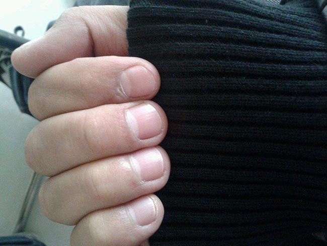 指甲半月痕代表什么 从指甲就能轻易看出健康程度