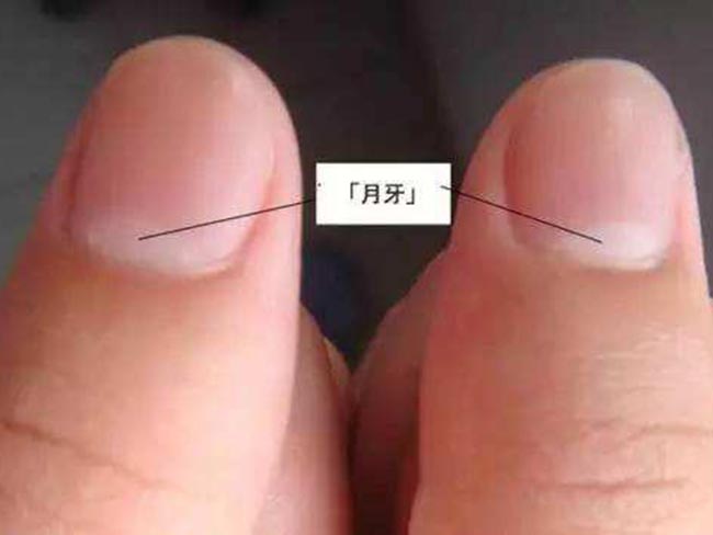 指甲半月痕代表什么 从指甲就能轻易看出健康程度