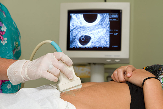 孕早期阴道出血是流产的征兆吗 导致阴道出血的原因有哪些