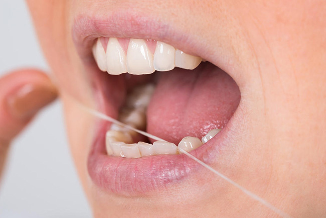 牙齿缝发黑怎么办 六大日常措施助你保养牙齿缝隙