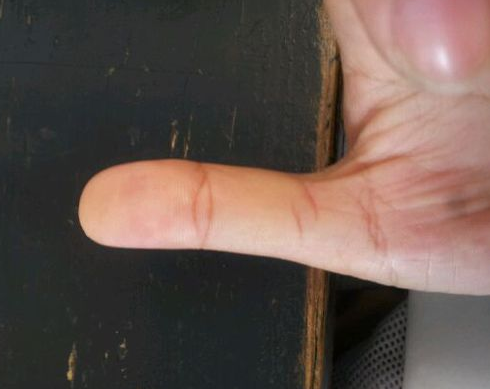 大拇指第一指节纹两条或三条