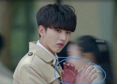 蔡徐坤首演男主角演技获好评 不过蔡徐坤手掌发红是怎么回事?