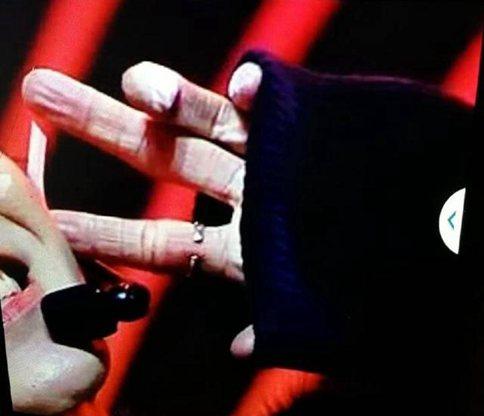 蔡徐坤首演男主角演技获好评 不过蔡徐坤手掌发红是怎么回事?