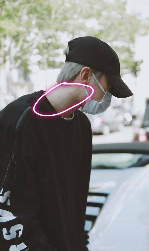 蔡徐坤在洛杉矶疑似过敏发作 细心粉丝反应暖心 蔡徐坤在洛杉矶疑似过敏发作 细心粉丝反应暖心