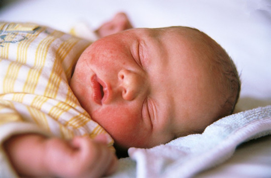 宝宝湿疹护理要点有哪些 宝宝湿疹期间妈妈们应该注意些什么