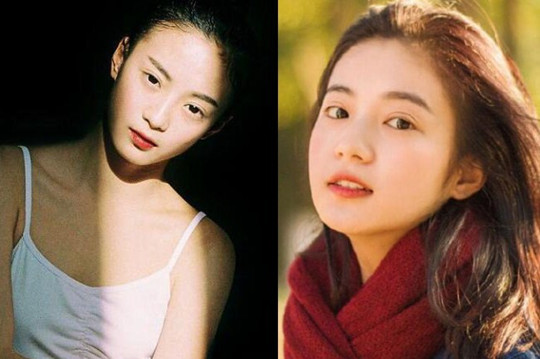 张雅钦是谁的艺人 张雅钦双眼皮割得不好