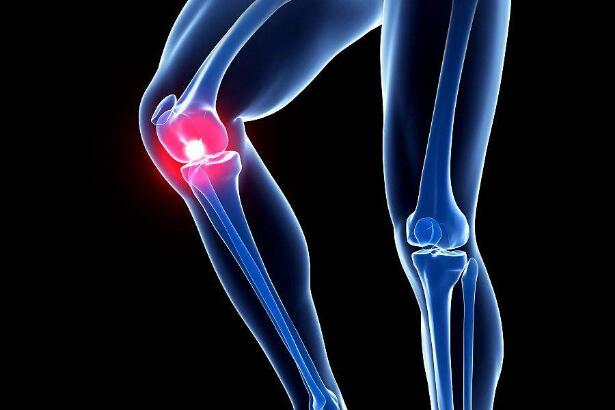 滑膜炎的治疗方法 膝盖上的毛病片刻不能耽误
