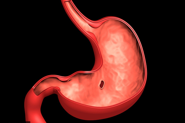 肚脐眼周围疼是怎么回事 肚脐可是人体健康的晴雨表