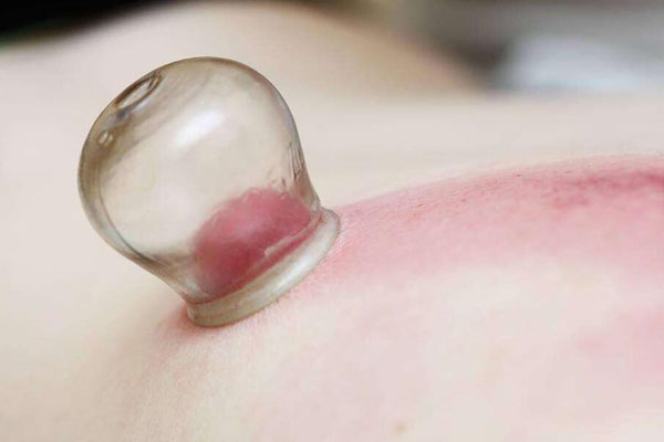 拔火罐几小时可以洗澡 拔罐后6小时能洗澡么