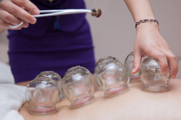 第一次拔火罐疼有多疼 网友口述初次拔罐体验