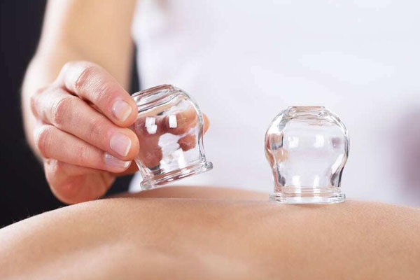 第一次拔火罐疼有多疼 网友口述初次拔罐体验