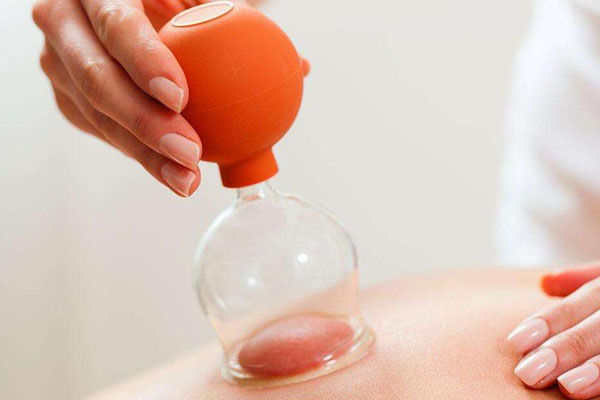 第一次拔火罐疼有多疼 网友口述初次拔罐体验