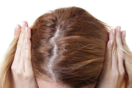 产后脱发是哪些原因造成的，需要治疗吗