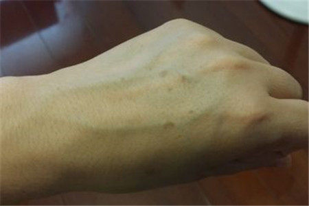 这几个异常突然出现，意味着你的衰老开始了