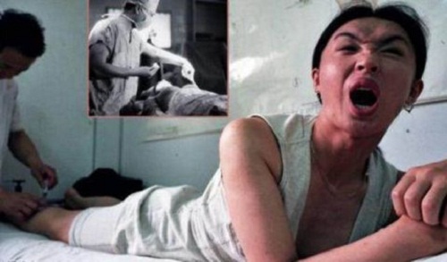 金星变性手术可以同房吗