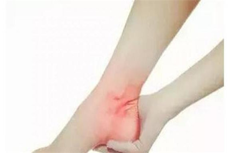脚后跟疼的原因
