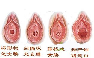 女性阴道生理结构图 最真实的女人阴道图片